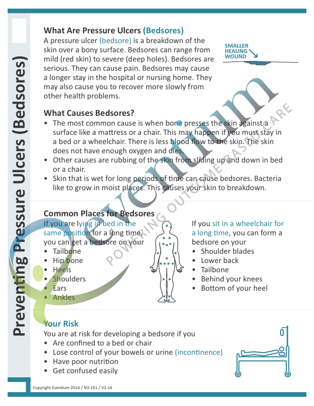 Preventing Pressure Ulcers (Bedsores) - Eventium