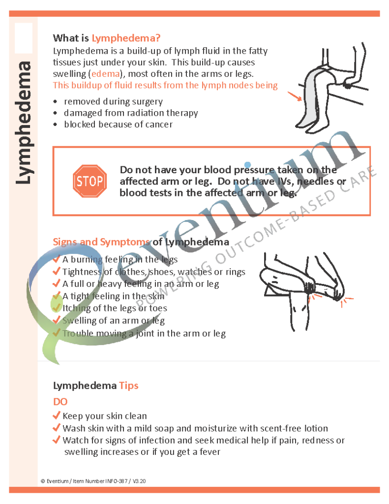 Lymphedema | Eventium